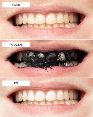 Smilebite Kokosnuss-Kohle-Zahnaufhellungspulver - 5