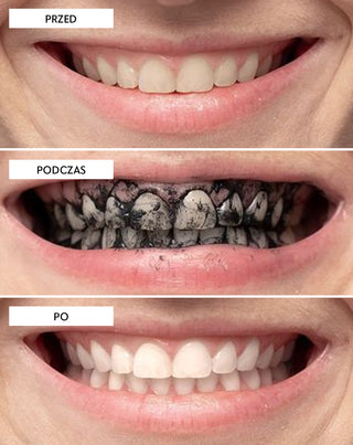 Smilebite Kokosnuss-Kohle-Zahnaufhellungspulver - 6